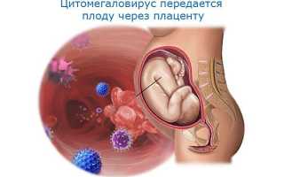 Замершая беременность на 10, 11 неделе