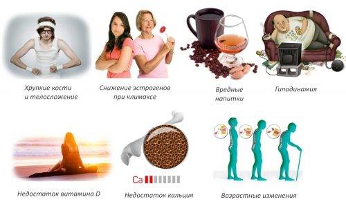 Причины остеопороза Причины остеопороза