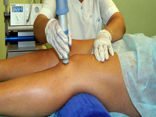 Лучевая терапия бурсита коленного сустава