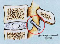 dugootroschatiy-systav