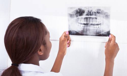 Причины и факторы риска артроза ВНЧС фото Причины и факторы риска артроза ВНЧС фото