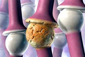 Причины артрита Причины артрита