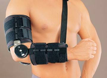 Перелом руки в локтевом суставе