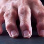 Полиартрит пальцев рук