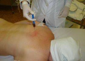 Уколы при боли в спине Уколы при боли в спине