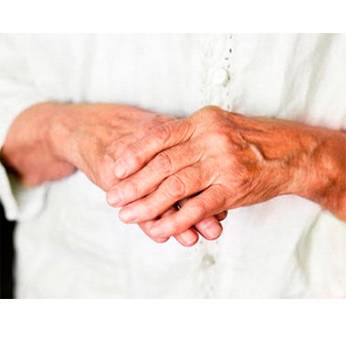 Полиартрит суставов пальцев рук Полиартрит пальцев рук