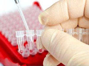 Надо сдать максимум анализов, от них будет зависеть правильность вашего лечения Анализ крови на ревматоидный артрит