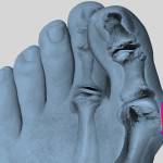 диагностика болей в ноге