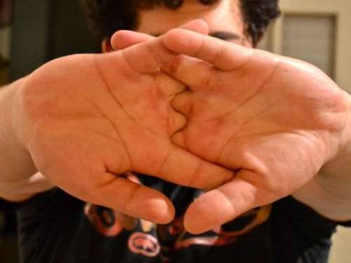 Почему хрустят кости