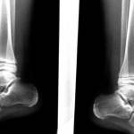 рентген голеностопа