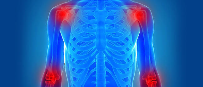 самые эффективные мази для суставов препараты