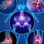 полиостеоартроз