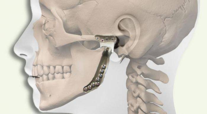 внчс проблемы и решения