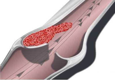 Почему ночью болят суставы