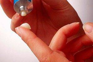 Мази при артритах и артрозах