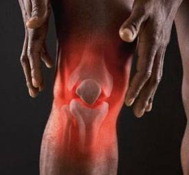 Артрит. Симптомы, причины, виды и лечение артрита Артрит. Симптомы, причины, виды и лечение артрита