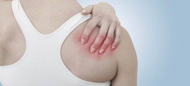 вывих плеча