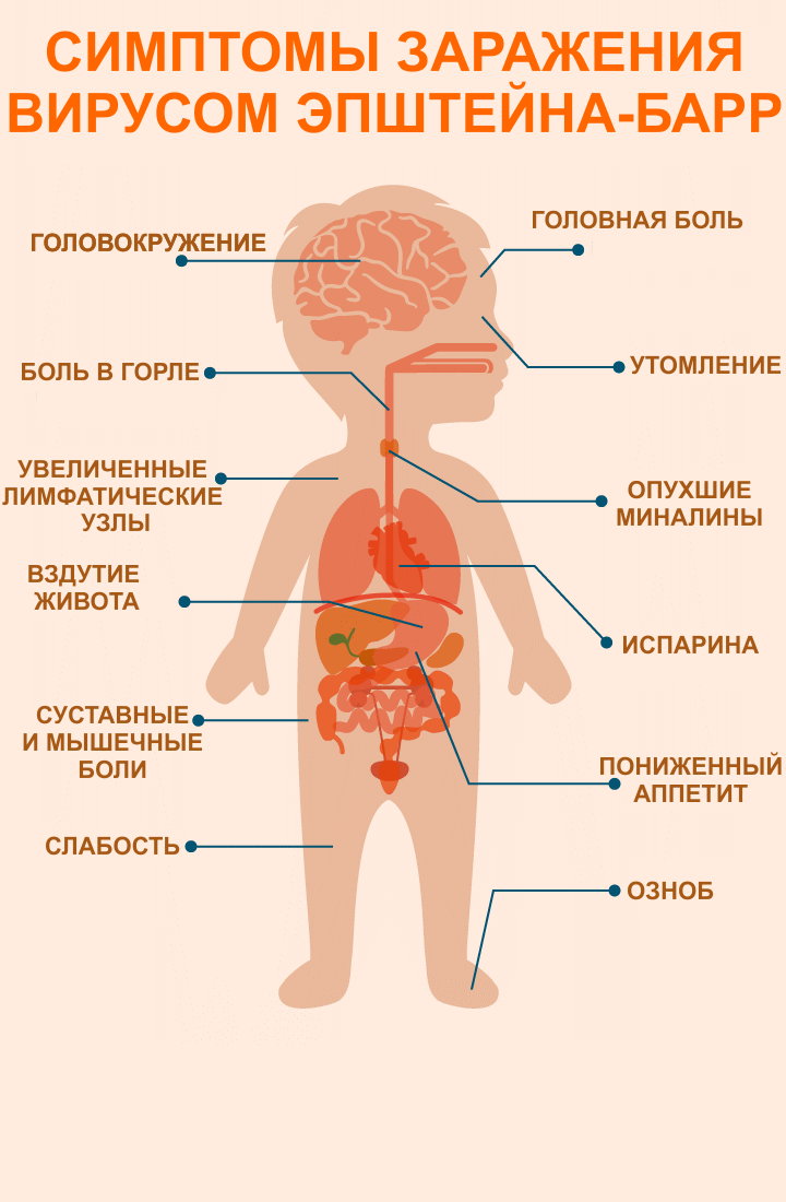 Симптомы ревматоидного артрита